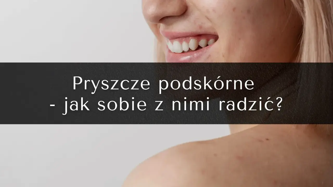 Pryszcze podskórne: Jak się ich pozbyć? Poradnik eksperta