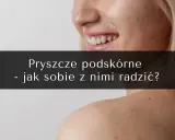 Pryszcze podskórne: Jak się ich pozbyć? Poradnik eksperta