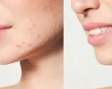 Twoja cera marzeń: Jak poprawić wygląd od diety po retinol?