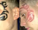Henna do brwi jako tatuaż? Ryzykujesz zdrowie i blizny!