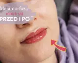 Metamorfoza moich ust przed i po. Czy makijaż permanentny ust boli? Zobacz efekt!